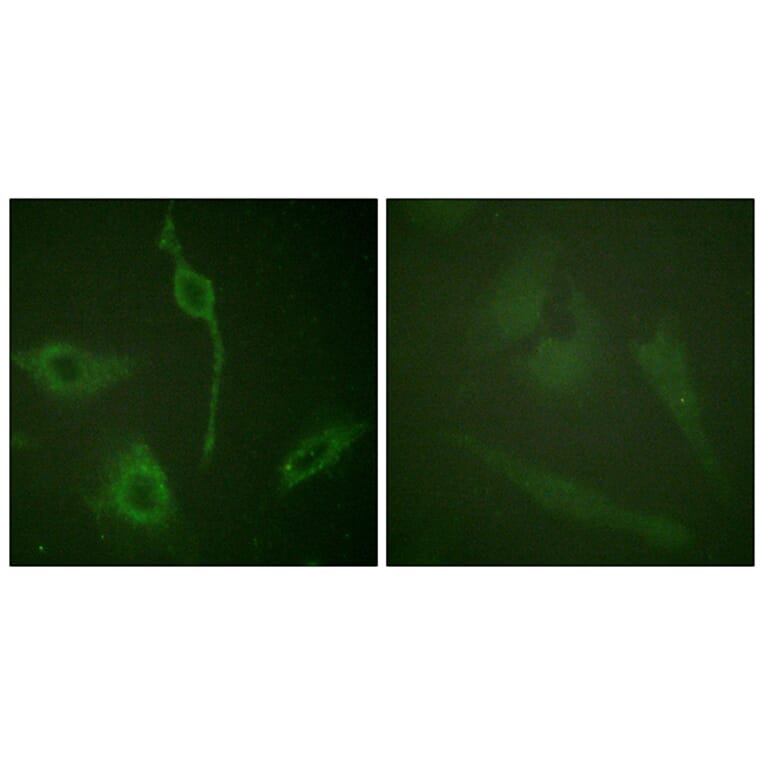 Immunofluorescence - Anti-PDGFR alpha Antibody (B0968) - Antibodies.com