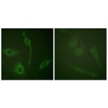 Immunofluorescence - Anti-PDGFR alpha Antibody (B0968) - Antibodies.com