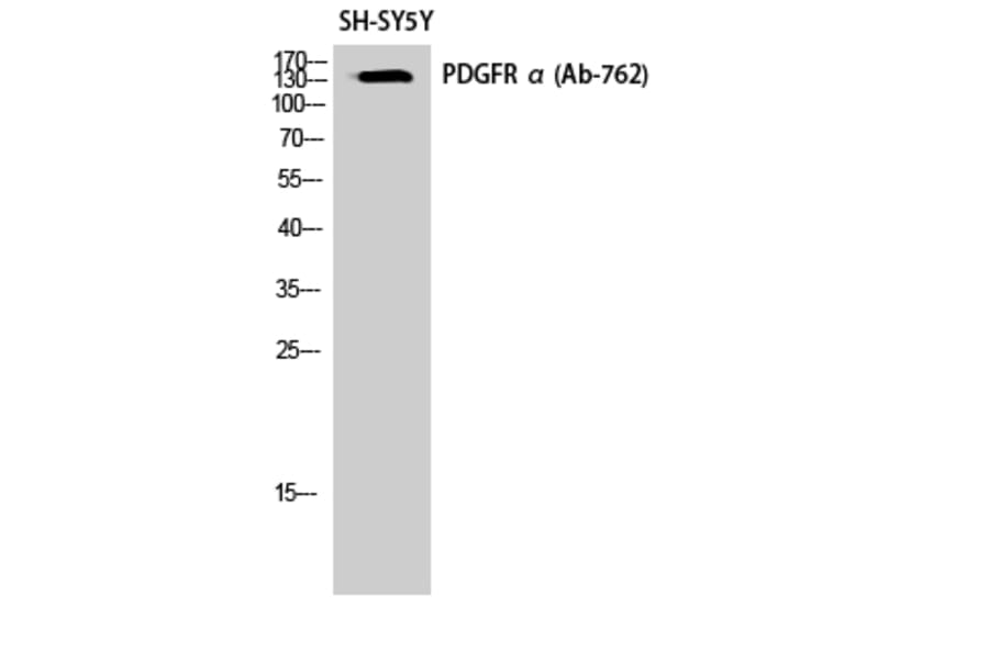 Western Blot - Anti-PDGFR alpha Antibody (B0968) - Antibodies.com