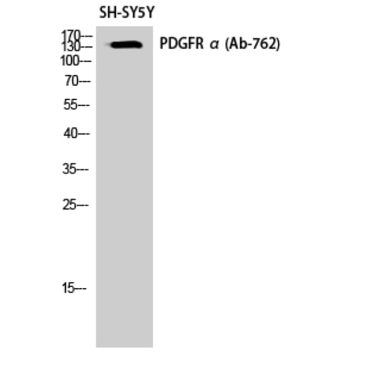 Western Blot - Anti-PDGFR alpha Antibody (B0968) - Antibodies.com