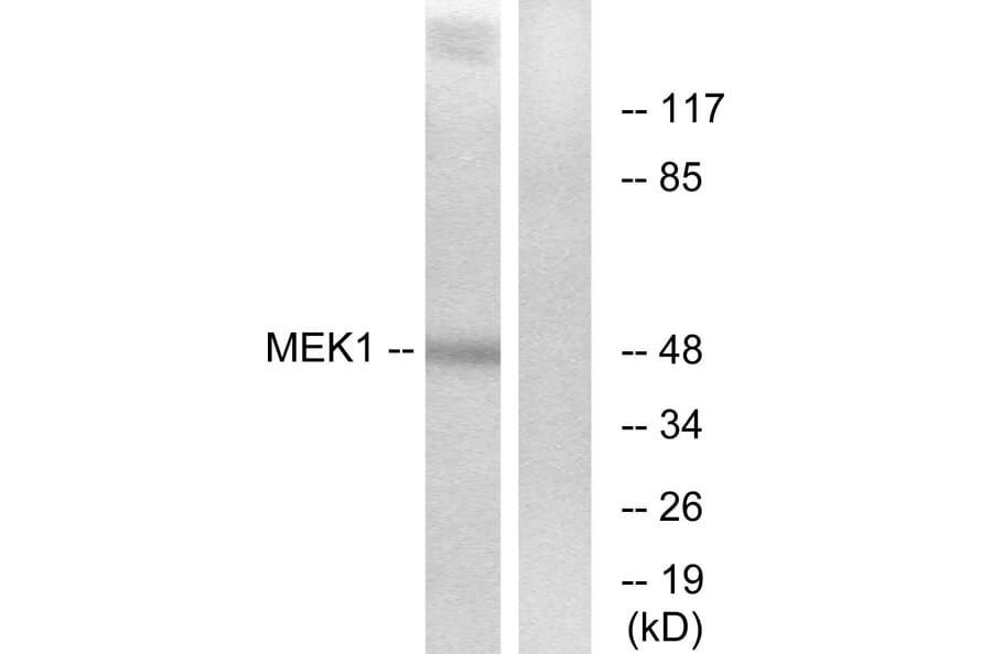 Western Blot - Anti-MEK1 + MEK2 Antibody (B7147) - Antibodies.com