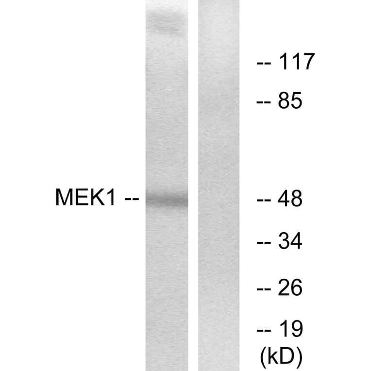 Western Blot - Anti-MEK1 + MEK2 Antibody (B7147) - Antibodies.com