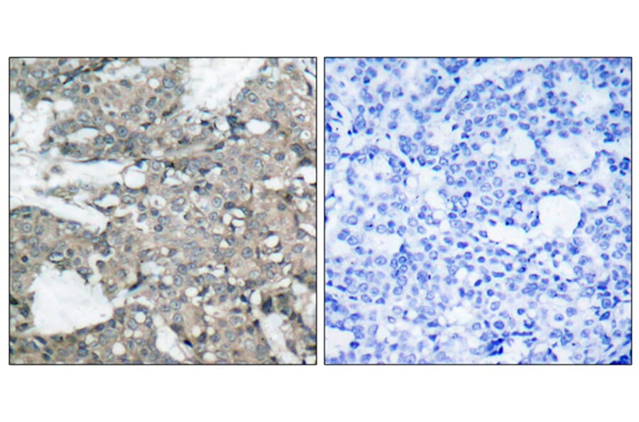 Immunohistochemistry - Anti-MEK1 + MEK2 Antibody (B7147) - Antibodies.com
