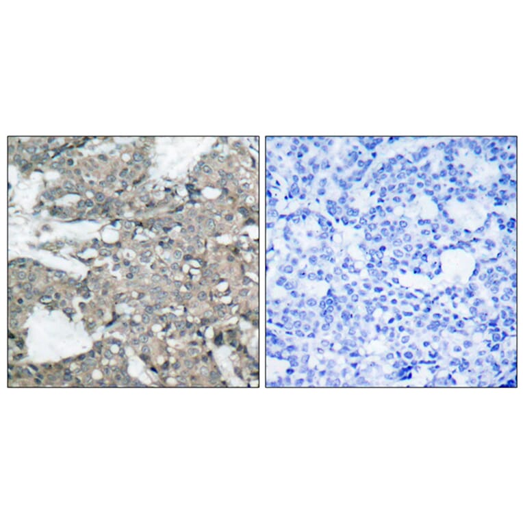 Immunohistochemistry - Anti-MEK1 + MEK2 Antibody (B7147) - Antibodies.com