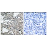 Immunohistochemistry - Anti-MEK1 + MEK2 Antibody (B7147) - Antibodies.com