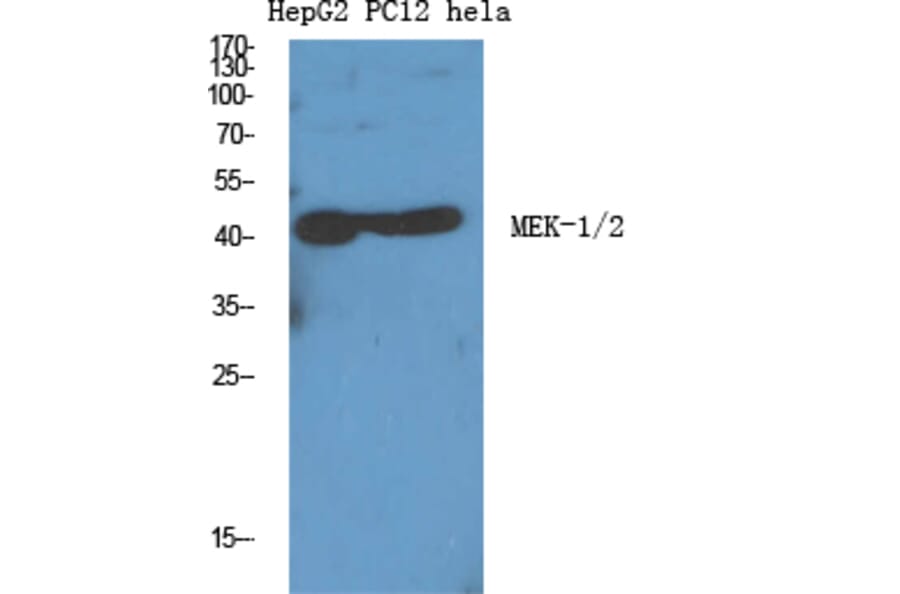 Western Blot - Anti-MEK1 + MEK2 Antibody (B7147) - Antibodies.com