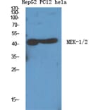 Western Blot - Anti-MEK1 + MEK2 Antibody (B7147) - Antibodies.com