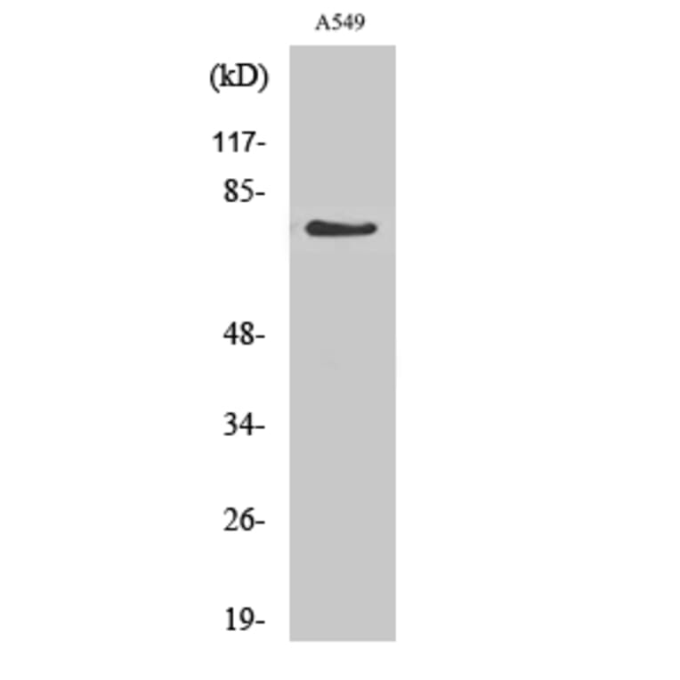Western Blot - Anti-GCS-alpha-1 Antibody (R12-2158) - Antibodies.com