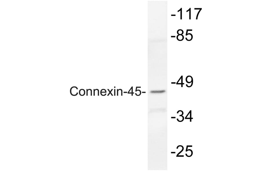 Western Blot - Anti-Connexin-45 Antibody (R12-2100) - Antibodies.com