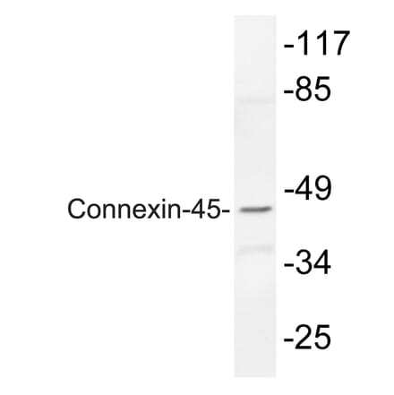 Western Blot - Anti-Connexin-45 Antibody (R12-2100) - Antibodies.com