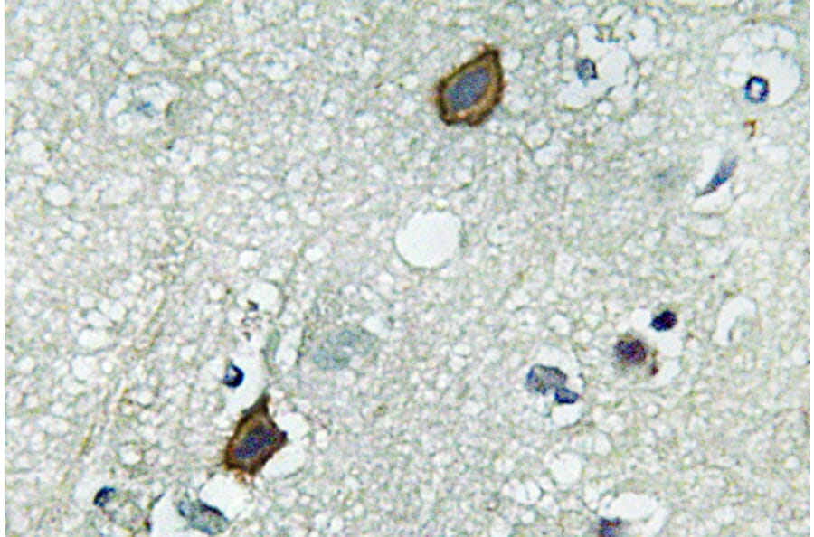 Immunohistochemistry - Anti-Connexin-45 Antibody (R12-2100) - Antibodies.com
