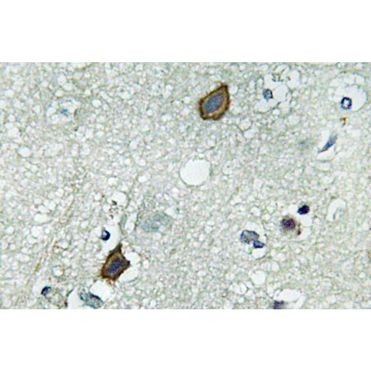 Immunohistochemistry - Anti-Connexin-45 Antibody (R12-2100) - Antibodies.com