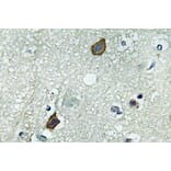 Immunohistochemistry - Anti-Connexin-45 Antibody (R12-2100) - Antibodies.com