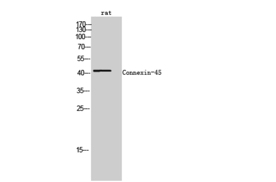 Western Blot - Anti-Connexin-45 Antibody (R12-2100) - Antibodies.com