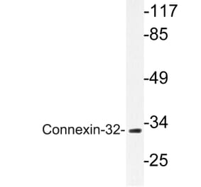 Western Blot - Anti-Connexin-32 Antibody (R12-2099) - Antibodies.com