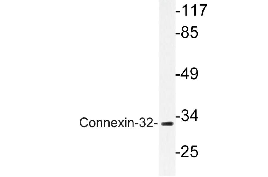 Western Blot - Anti-Connexin-32 Antibody (R12-2099) - Antibodies.com