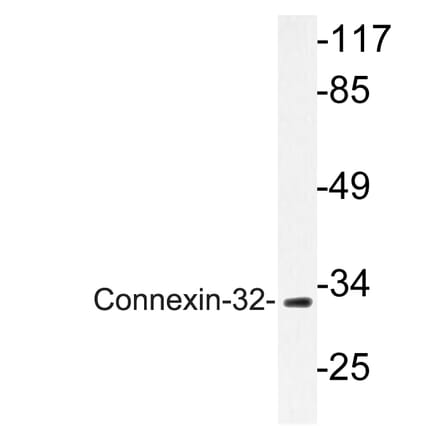 Western Blot - Anti-Connexin-32 Antibody (R12-2099) - Antibodies.com