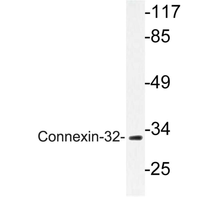 Western Blot - Anti-Connexin-32 Antibody (R12-2099) - Antibodies.com