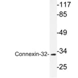 Western Blot - Anti-Connexin-32 Antibody (R12-2099) - Antibodies.com