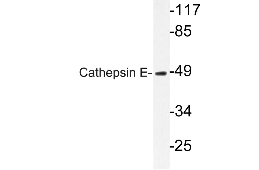 Western Blot - Anti-Cathepsin E Antibody (R12-2058) - Antibodies.com