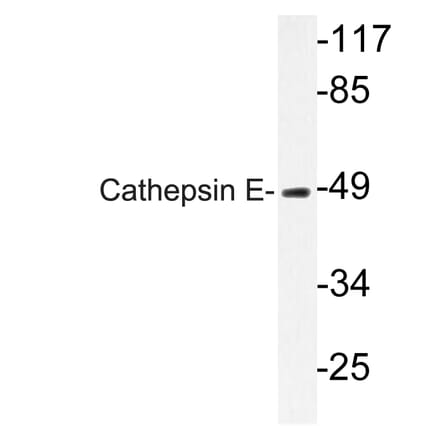Western Blot - Anti-Cathepsin E Antibody (R12-2058) - Antibodies.com
