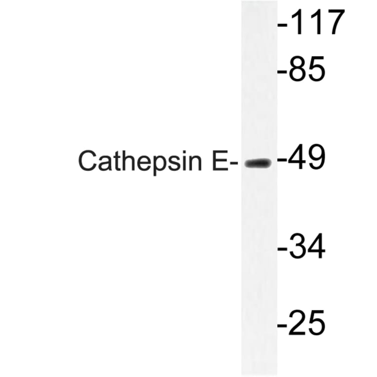 Western Blot - Anti-Cathepsin E Antibody (R12-2058) - Antibodies.com