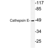 Western Blot - Anti-Cathepsin E Antibody (R12-2058) - Antibodies.com