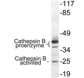Western Blot - Anti-Cathepsin B Antibody (R12-2057) - Antibodies.com