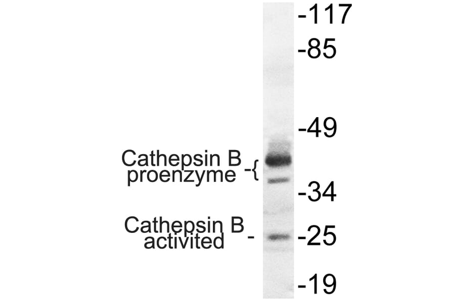 Western Blot - Anti-Cathepsin B Antibody (R12-2057) - Antibodies.com