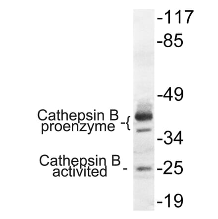 Western Blot - Anti-Cathepsin B Antibody (R12-2057) - Antibodies.com