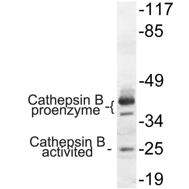 Western Blot - Anti-Cathepsin B Antibody (R12-2057) - Antibodies.com