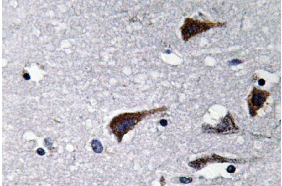 Immunohistochemistry - Anti-Cathepsin B Antibody (R12-2057) - Antibodies.com