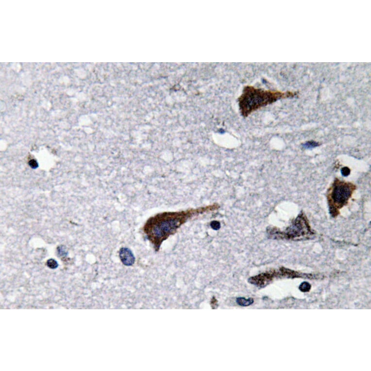 Immunohistochemistry - Anti-Cathepsin B Antibody (R12-2057) - Antibodies.com