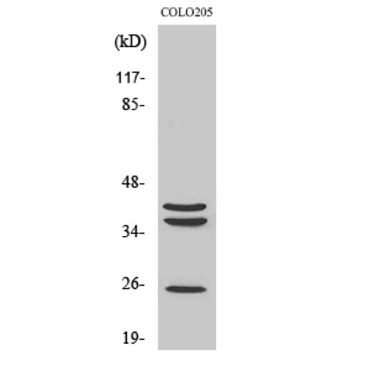 Western Blot - Anti-Cathepsin B Antibody (R12-2057) - Antibodies.com