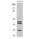 Western Blot - Anti-Cathepsin B Antibody (R12-2057) - Antibodies.com