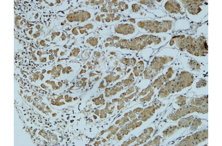 Immunohistochemistry - Anti-Cathepsin B Antibody (R12-2057) - Antibodies.com