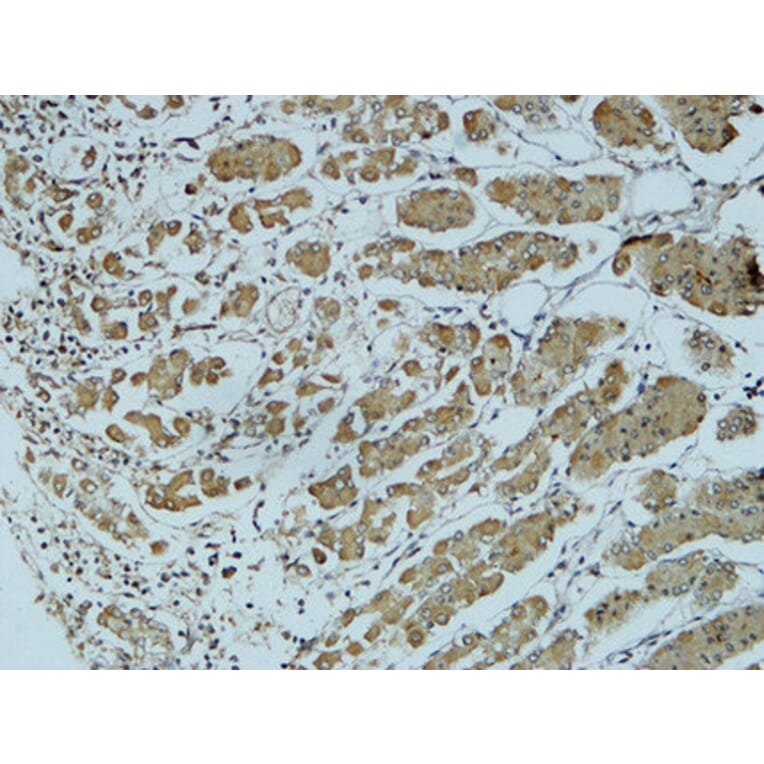 Immunohistochemistry - Anti-Cathepsin B Antibody (R12-2057) - Antibodies.com