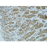 Immunohistochemistry - Anti-Cathepsin B Antibody (R12-2057) - Antibodies.com