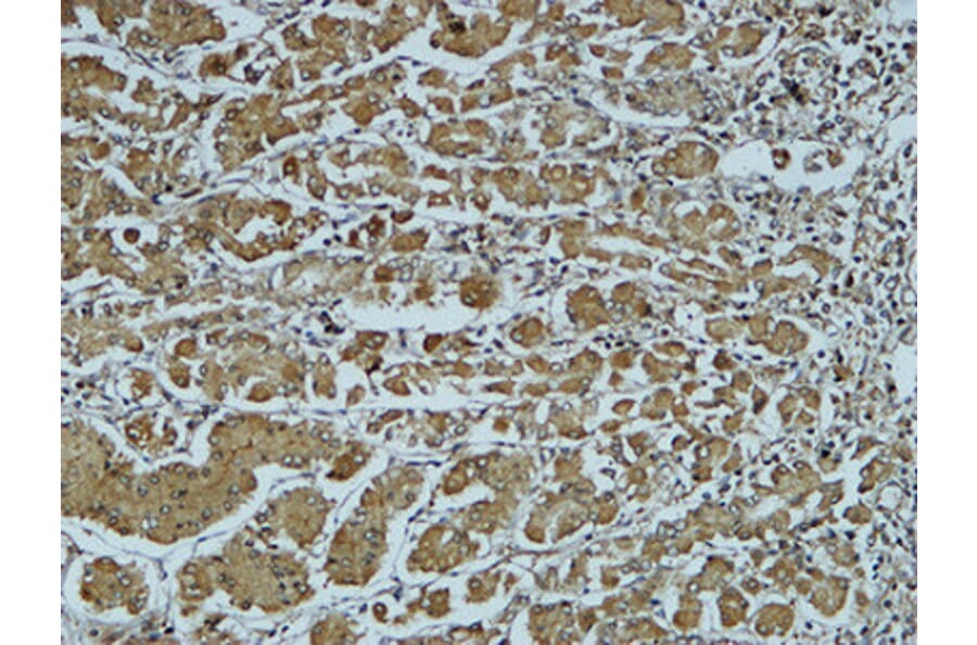 Immunohistochemistry - Anti-Cathepsin B Antibody (R12-2057) - Antibodies.com