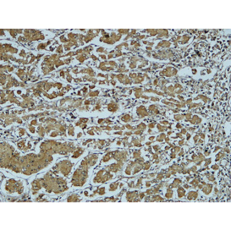 Immunohistochemistry - Anti-Cathepsin B Antibody (R12-2057) - Antibodies.com