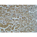 Immunohistochemistry - Anti-Cathepsin B Antibody (R12-2057) - Antibodies.com