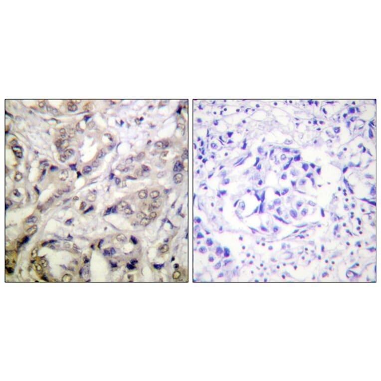 Immunohistochemistry - Anti-CaMK1-alpha Antibody (B0830) - Antibodies.com
