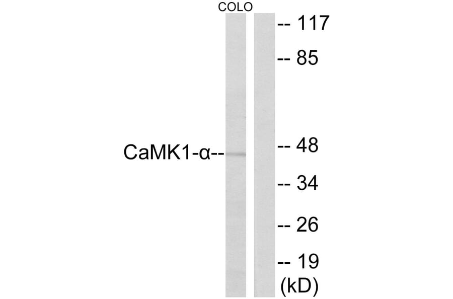 Western Blot - Anti-CaMK1-alpha Antibody (B0830) - Antibodies.com