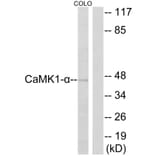 Western Blot - Anti-CaMK1-alpha Antibody (B0830) - Antibodies.com