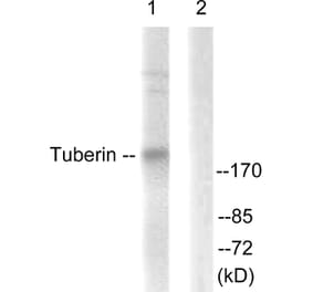 Western Blot - Anti-Tuberin Antibody (B0590) - Antibodies.com