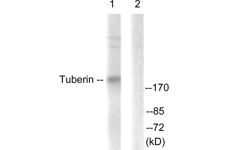 Western Blot - Anti-Tuberin Antibody (B0590) - Antibodies.com