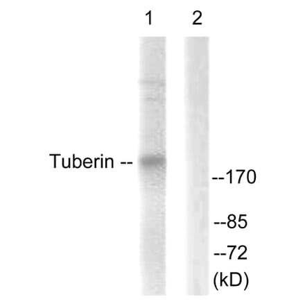 Western Blot - Anti-Tuberin Antibody (B0590) - Antibodies.com