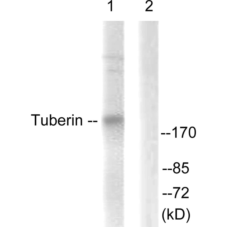 Western Blot - Anti-Tuberin Antibody (B0590) - Antibodies.com