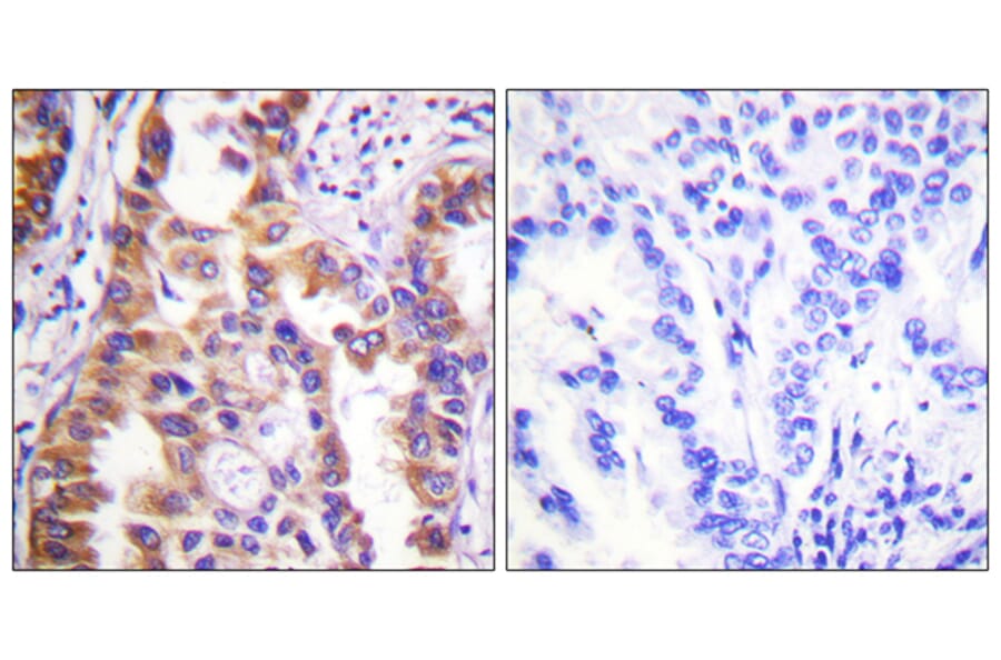 Immunohistochemistry - Anti-Tuberin Antibody (B0590) - Antibodies.com
