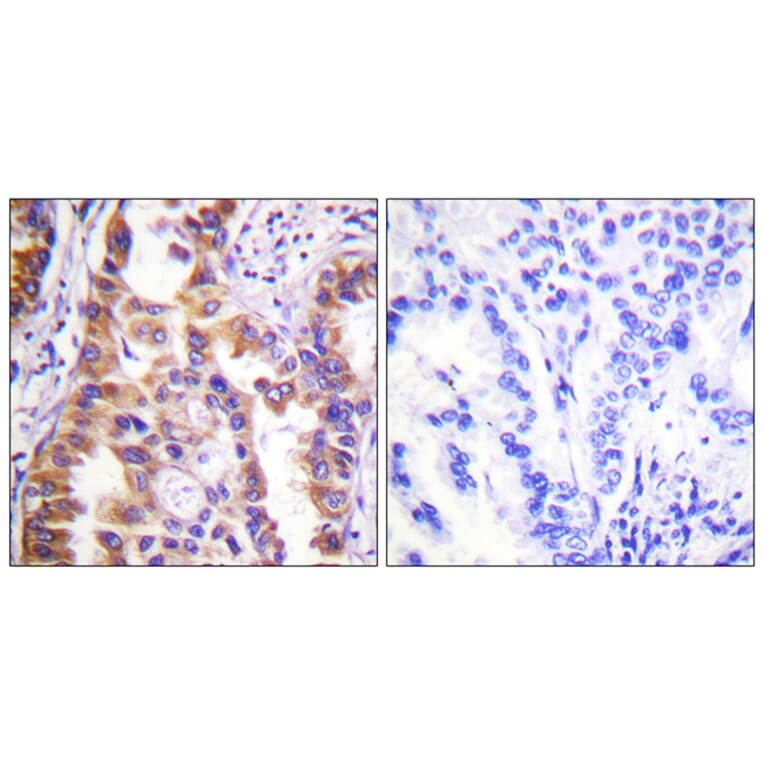 Immunohistochemistry - Anti-Tuberin Antibody (B0590) - Antibodies.com